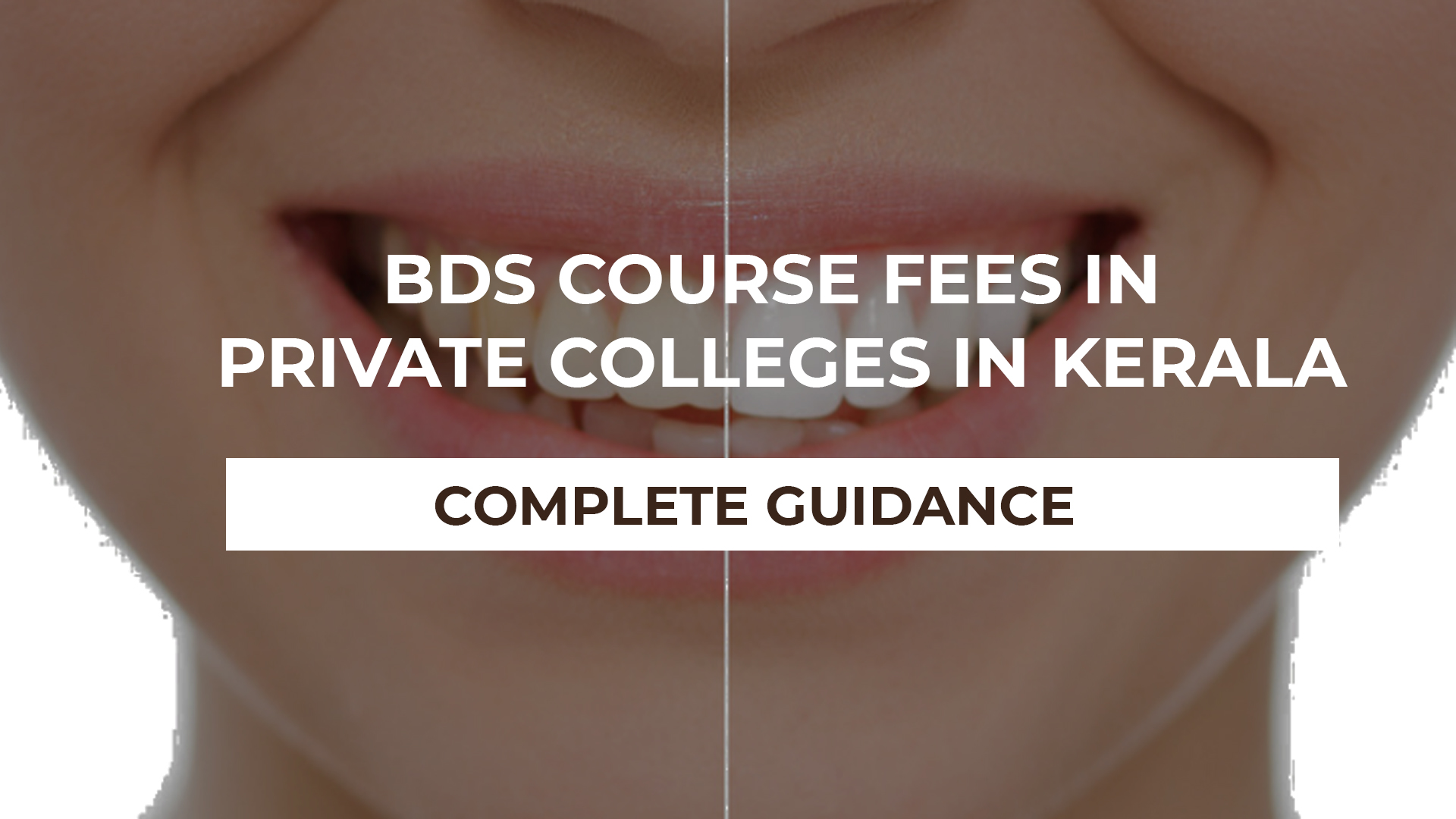 BDS Course fees in Kerala Private Colleges and Management Quota