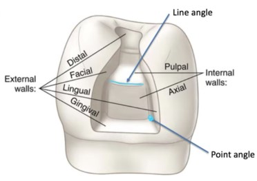Line angle in cavity preparation.